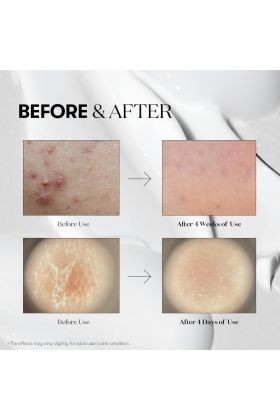 VT COSMETICS CICA Reedle Shot 100